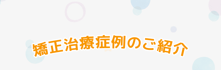 矯正治療症例のご紹介